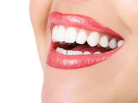 invisalign-IMG